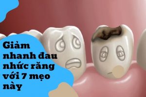 Mẹo chữa sâu răng tại nhà